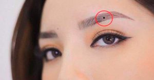 Nốt ruồi trong lông mày