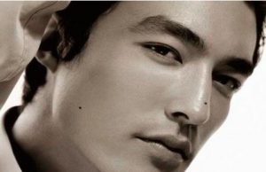 Nốt ruồi ở gò má