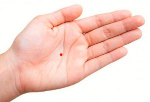 Nốt ruồi son phong thủy trong lòng bàn tay