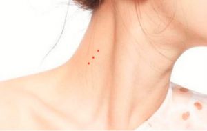 Ý nghĩa nốt ruồi son phong thủy trên cổ